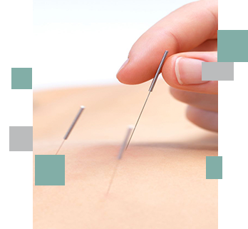 acupuncture