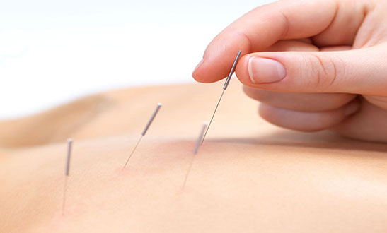 acupuncturepage